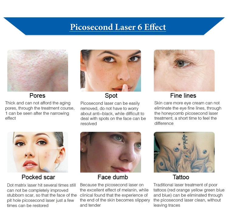 Best Quality Portable Picosur Picosecond Laser for All Pigment Removal and Tattoo